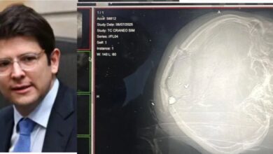 Photo of A Miguel Uribe ya lograron cerrarle el cráneo gracias a que desinflamó su cerebro