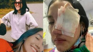 Photo of Condenan a 7 años de prisión a agente del Esmad por lesión que causó pérdida de un ojo a mujer